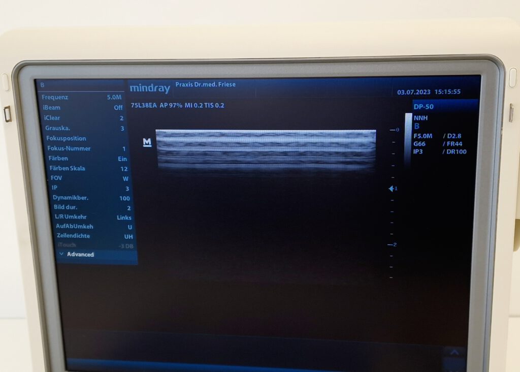 Mindray Dp Ultraschallger T Portabel Kompakt Digital Ultrasonic Diagnostic Imaging System