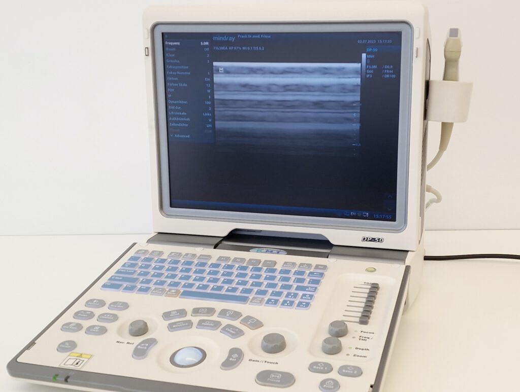 Mindray Dp Ultraschallger T Portabel Kompakt Digital Ultrasonic Diagnostic Imaging System